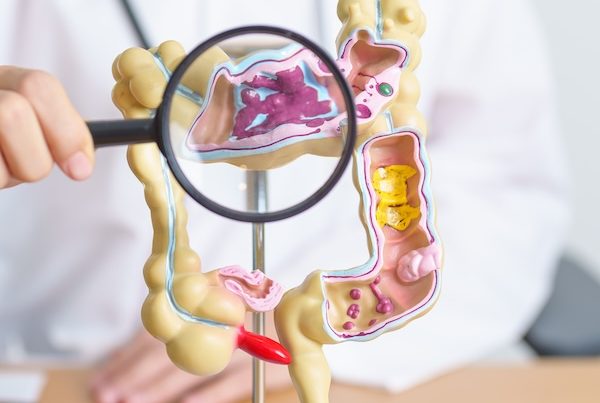 Cancer Treatments