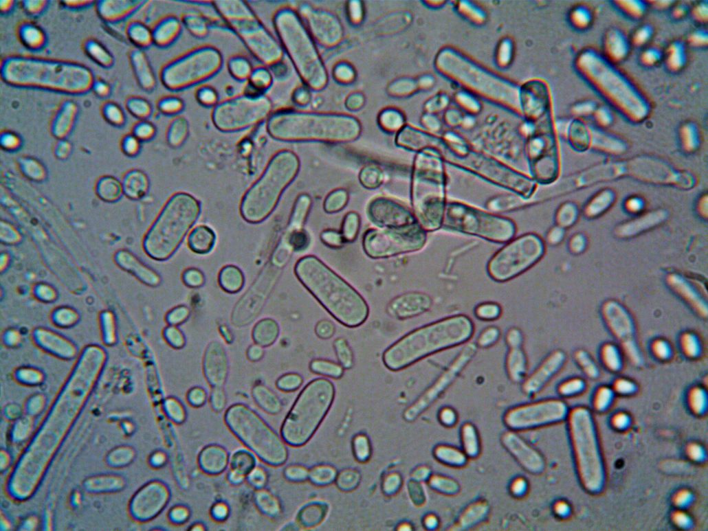 gut bacteria